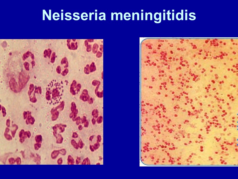 Neisseria meningitidis